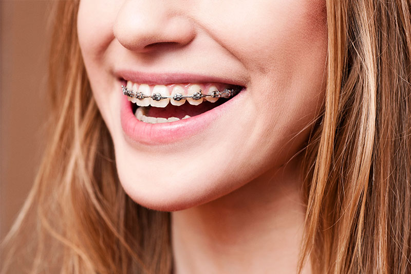 Orthodontics in Pennsauken