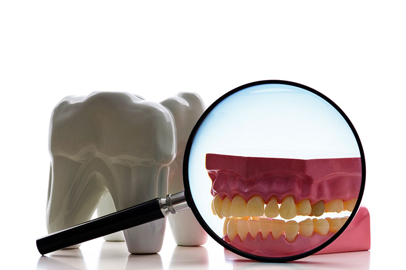 Root Canal Treatment in Pennsauken